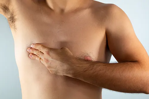 Cancer du sein chez l'homme